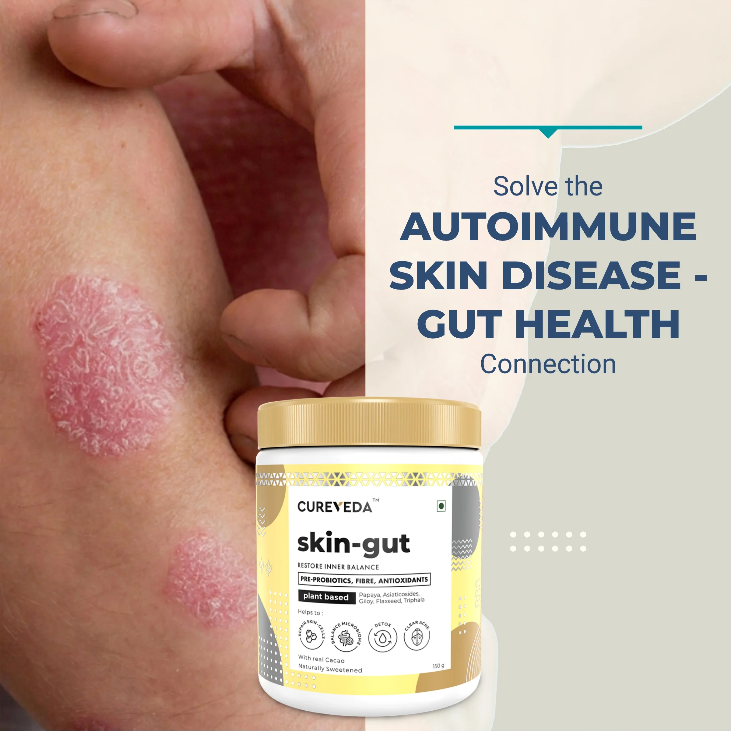 Cureveda Skin-gut with Pre-probiotics - Image 8